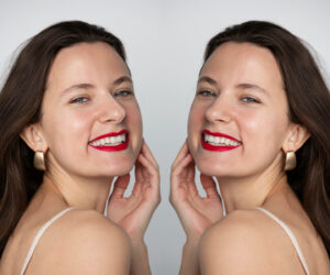 Teeth Whitening at Home vs. Professional in Calgary Serenity Smiles