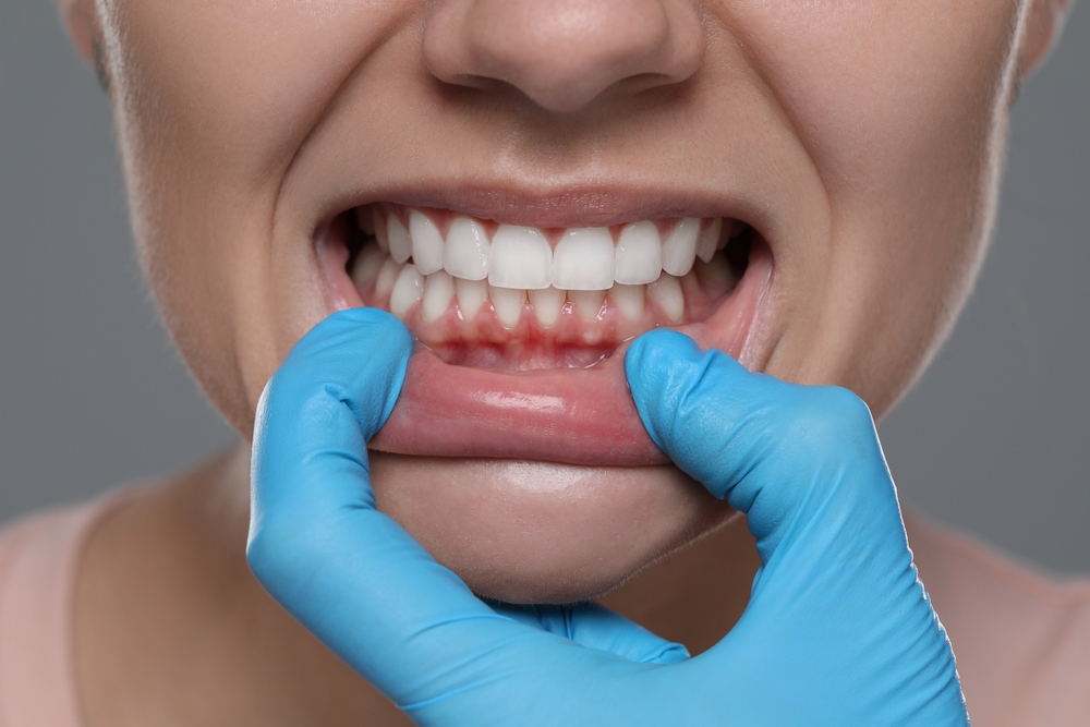 worried about gum disease? how scaling and root planing helps